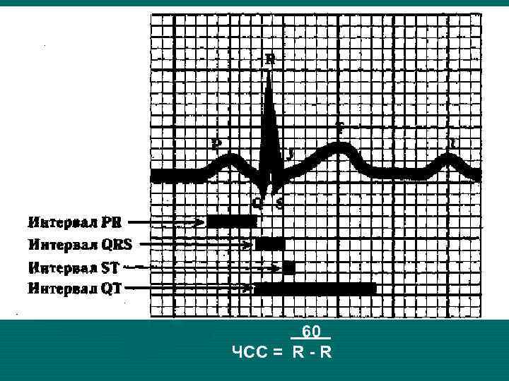 60 ЧСС = R - R 
