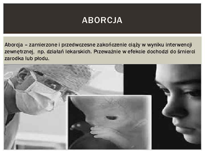 ABORCJA Aborcja – zamierzone i przedwczesne zakończenie ciąży w wyniku interwencji zewnętrznej, np. działań