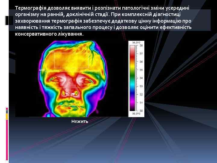 Термографія дозволяє виявити і розпізнати патологічні зміни усередині організму на ранній, доклінічній стадії. При