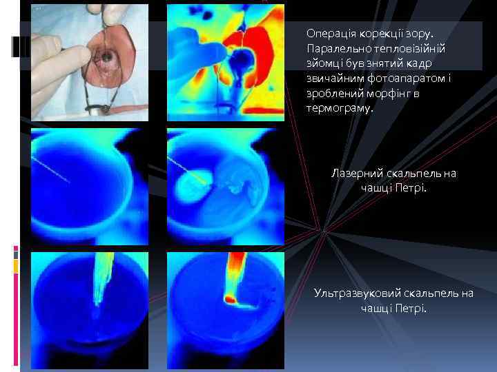 Операція корекції зору. Паралельно тепловізійній зйомці був знятий кадр звичайним фотоапаратом і зроблений морфінг