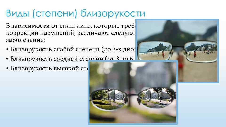 Виды (степени) близорукости В зависимости от силы линз, которые требуются для коррекции нарушений, различают