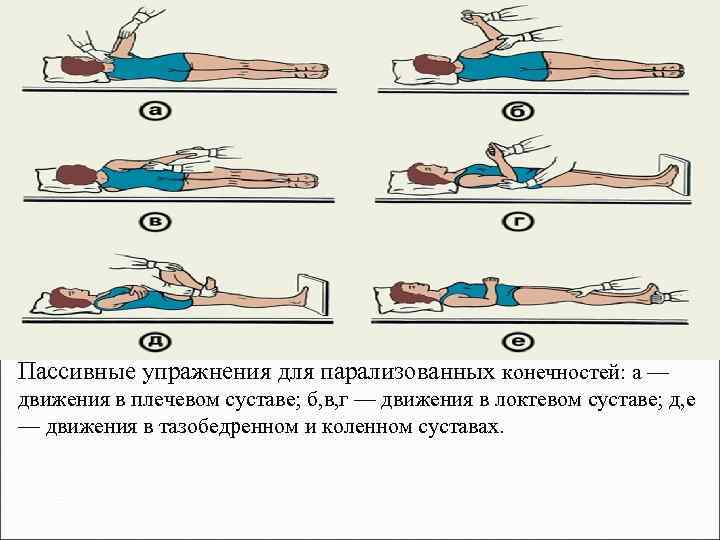 Пассивные упражнения для парализованных конечностей: а — движения в плечевом суставе; б, в, г