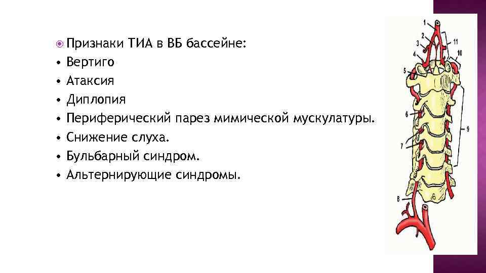 Признаки • • ТИА в ВБ бассейне: Вертиго Атаксия Диплопия Периферический парез мимической