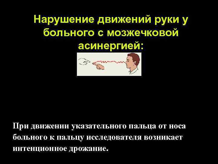 Нарушение движений руки у больного с мозжечковой асинергией: При движении указательного пальца от носа