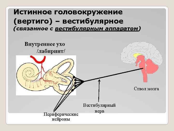 Истинное головокружение (вертиго) – вестибулярное (связанное с вестибулярным аппаратом) Внутреннее ухо /лабиринт/ Ствол мозга