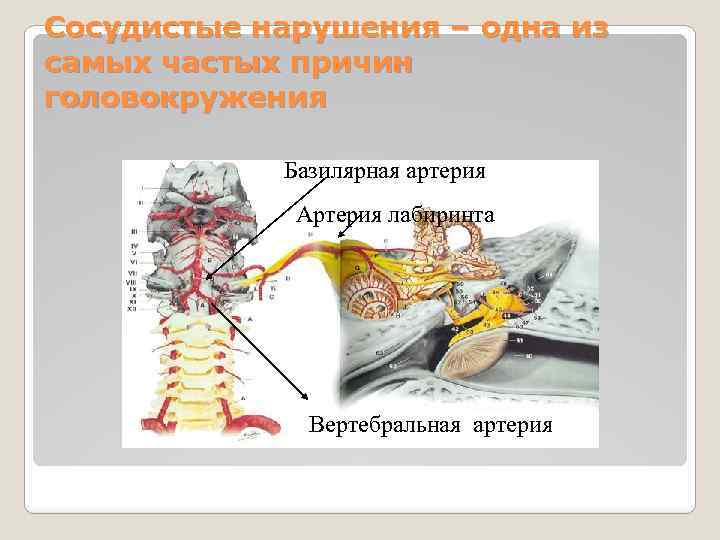 Сосудистые нарушения – одна из самых частых причин головокружения Базилярная артерия Артерия лабиринта Вертебральная