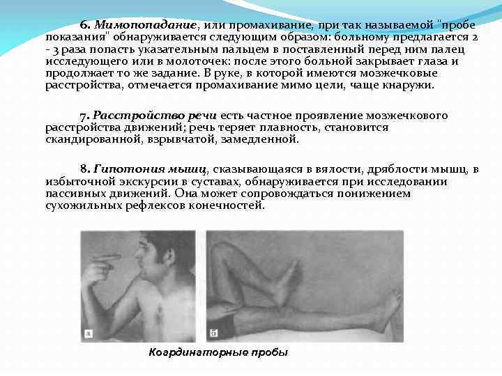 6. Мимопопадание, или промахивание, при так называемой 