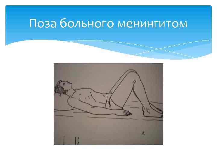 Поза больного менингитом 