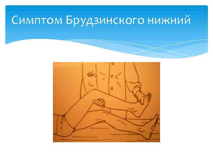 Симптом Брудзинского нижний 