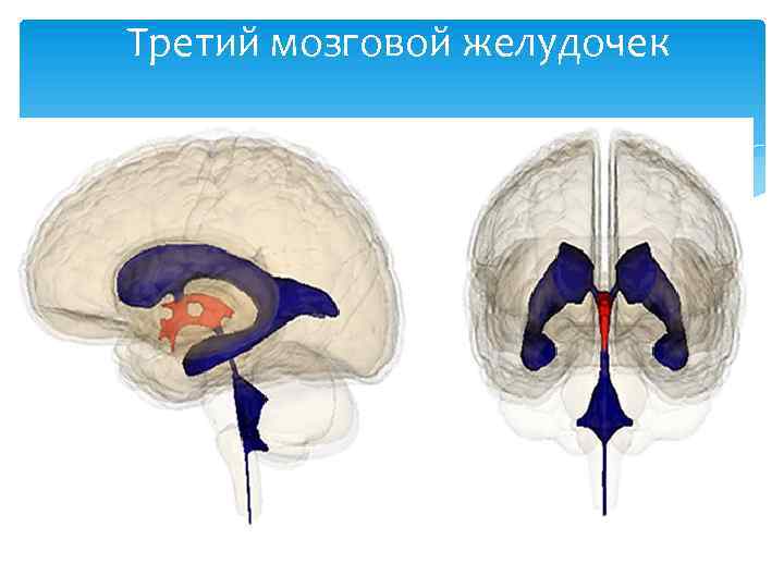 Третий мозговой желудочек 