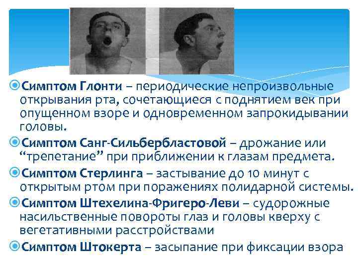  Симптом Глонти – периодические непроизвольные открывания рта, сочетающиеся с поднятием век при опущенном