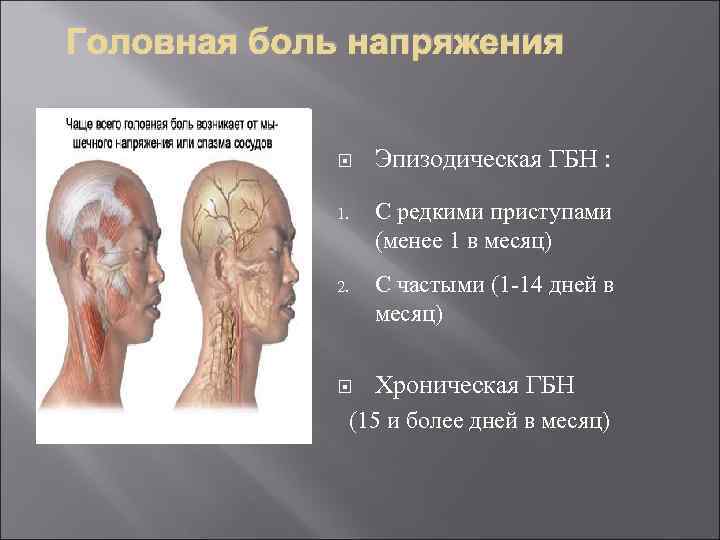 Головная боль напряжения Эпизодическая ГБН : 1. С редкими приступами (менее 1 в месяц)