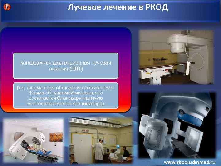 Лучевое лечение в РКОД Конформная дистанционная лучевая терапия (ДЛТ) (т. е. форма поля облучения