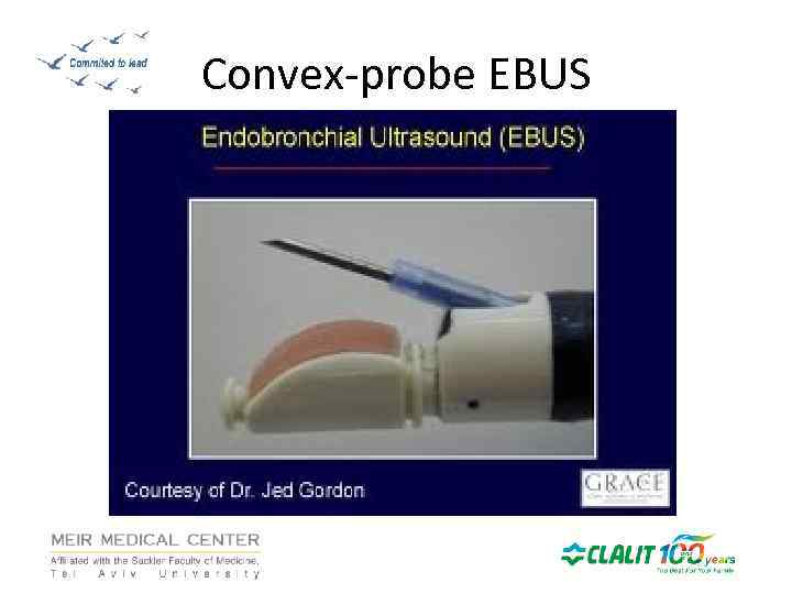 Convex-probe EBUS 