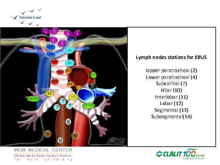 Lymph nodes stations for EBUS Upper paratracheal (2) Lower paratracheal (4) Subcarinal (7) Hilar