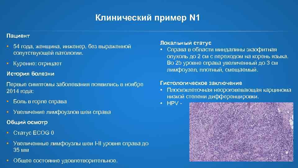 Клинический пример N 1 Пациент • 54 года, женщина, инженер, без выраженной сопутствующей патологии.