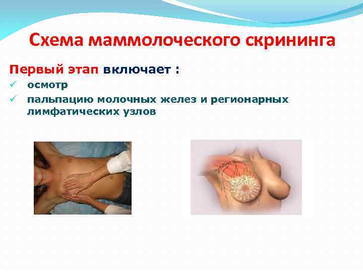 Схема маммолоческого скрининга Первый этап включает : ü ü осмотр пальпацию молочных желез и