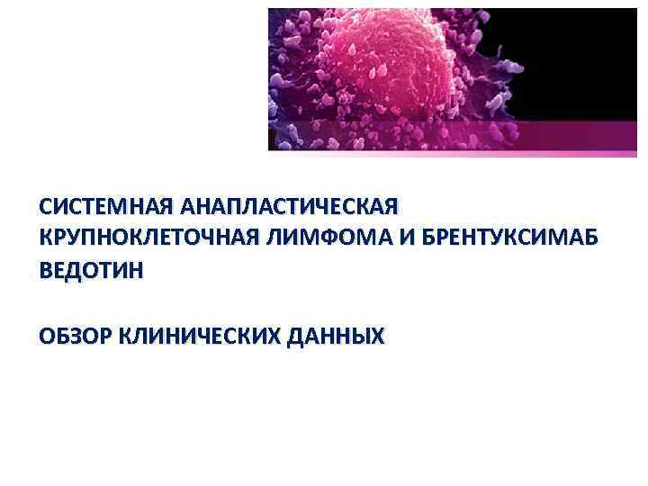 Крупноклеточная лимфома. Крупноклеточная лимфома симптомы. Анапластическая крупноклеточная лимфома. Т клеточная анапластическая крупноклеточная лимфома. Анапластическая крупноклеточная, alk-негативная лимфома.