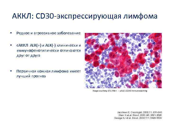 Диффузная в клеточная лимфома клинические рекомендации