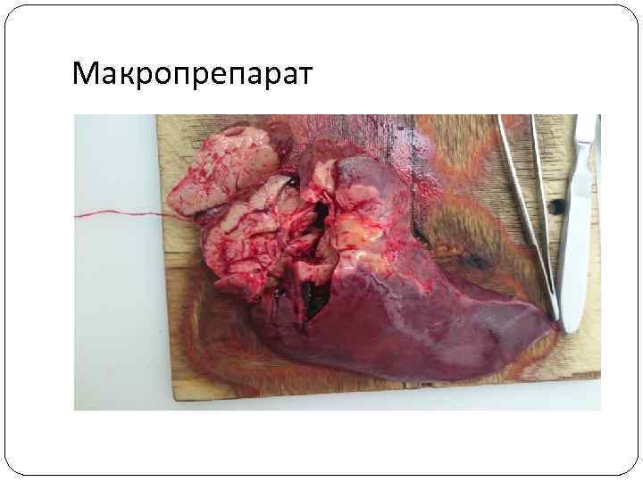 Макропрепарат 