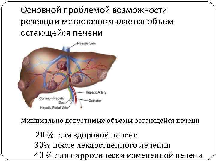 Основной проблемой возможности резекции метастазов является объем остающейся печени Минимально допустимые объемы остающейся печени