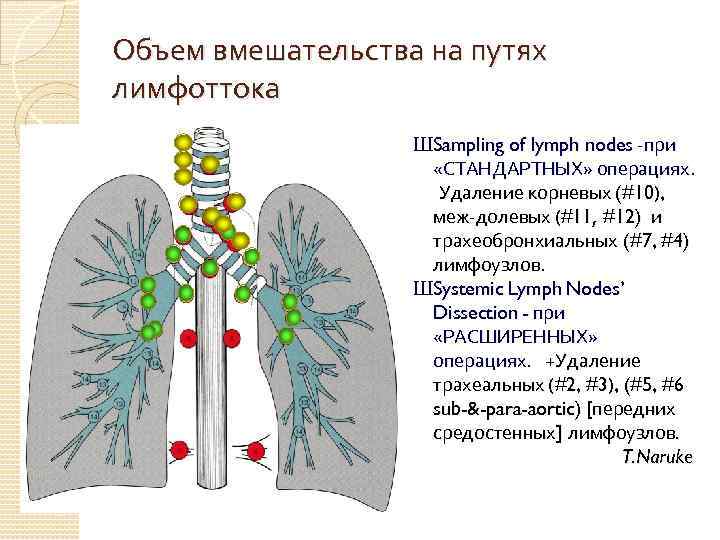 Объем вмешательства на путях лимфоттока ШSampling of lymph nodes -при «СТАНДАРТНЫХ» операциях. Удаление корневых
