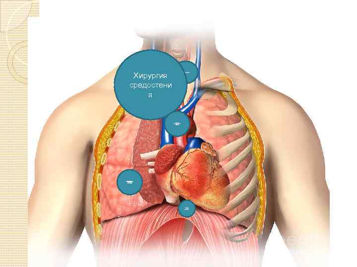 Хирургия средостени я Хирургия трахеи хирургия магистральных сосудов Хирургия легких Хирургия пищевода 