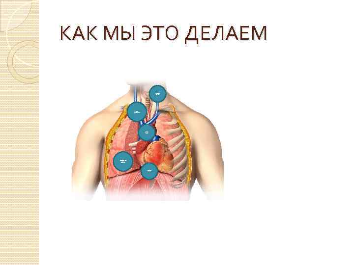 КАК МЫ ЭТО ДЕЛАЕМ Хирургия трахеи Хирургия средостения хирургия магистральных сосудов Хирургия легких Хирургия