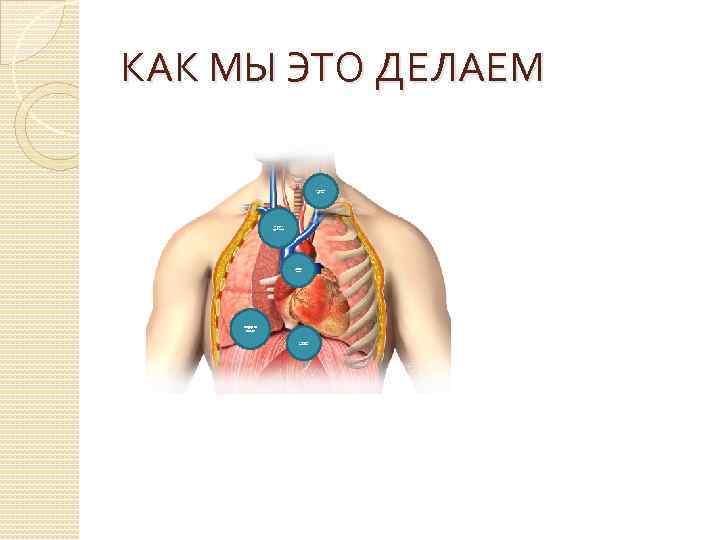 КАК МЫ ЭТО ДЕЛАЕМ Хирургия трахеи Хирургия средостения хирургия магистральных сосудов Хирургия легких Хирургия