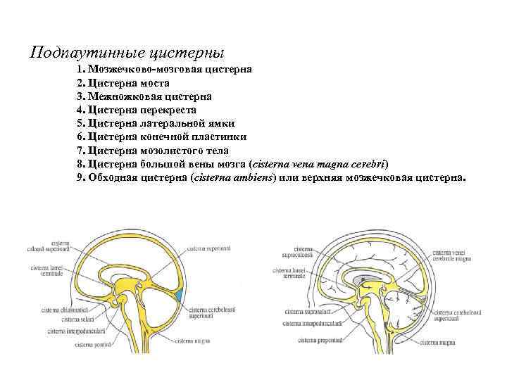 Цистерна головного мозга расширена