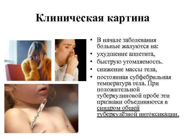 Клиническая картина • В начале заболевания больные жалуются на: • ухудшение аппетита, • быструю