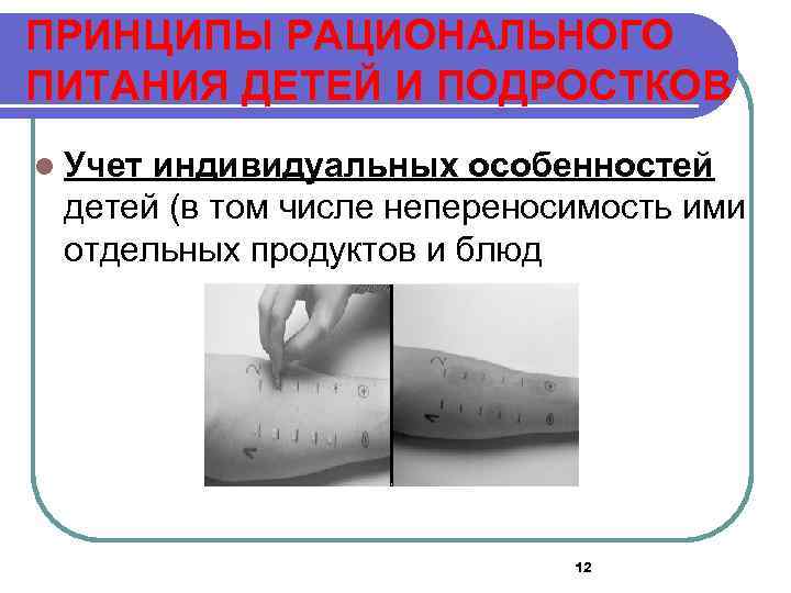 ПРИНЦИПЫ РАЦИОНАЛЬНОГО ПИТАНИЯ ДЕТЕЙ И ПОДРОСТКОВ l Учет индивидуальных особенностей детей (в том числе