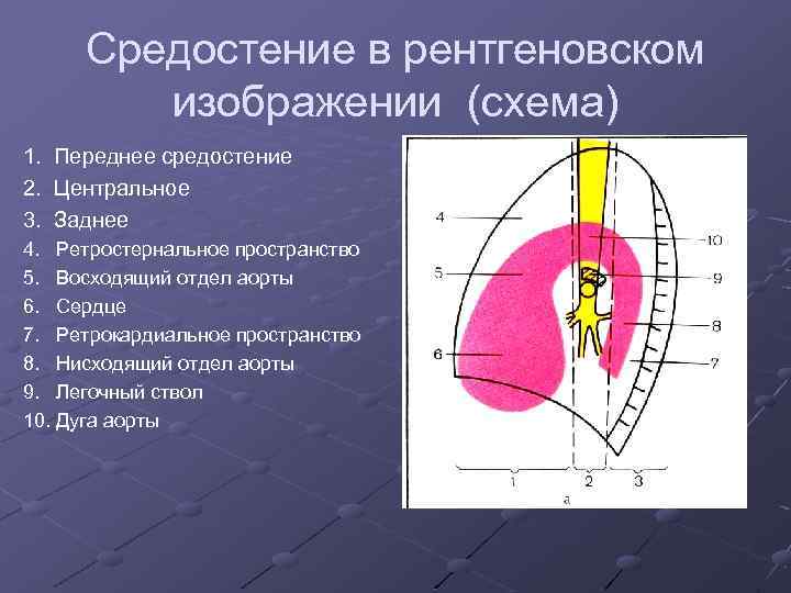 Средостение в рентгеновском изображении (схема) 1. Переднее средостение 2. Центральное 3. Заднее 4. Ретростернальное