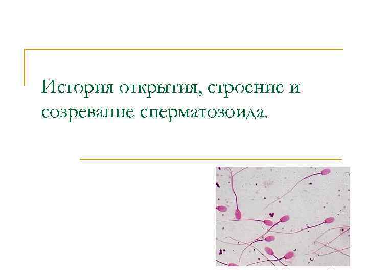История открытия, строение и созревание сперматозоида. 