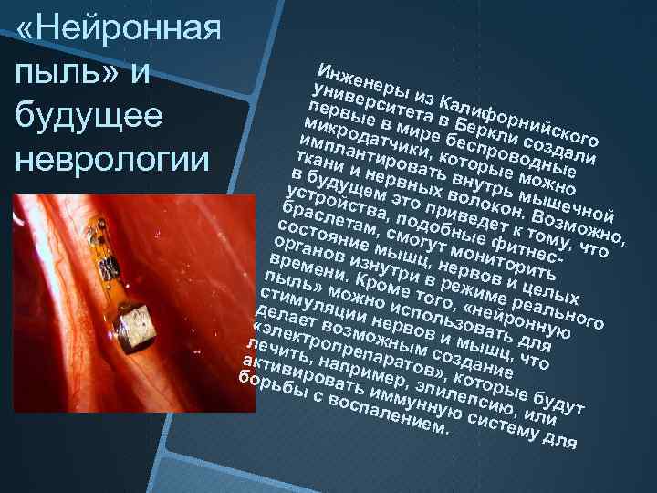  «Нейронная пыль» и будущее неврологии Инж унивенеры и перв ерсите з Калиф т