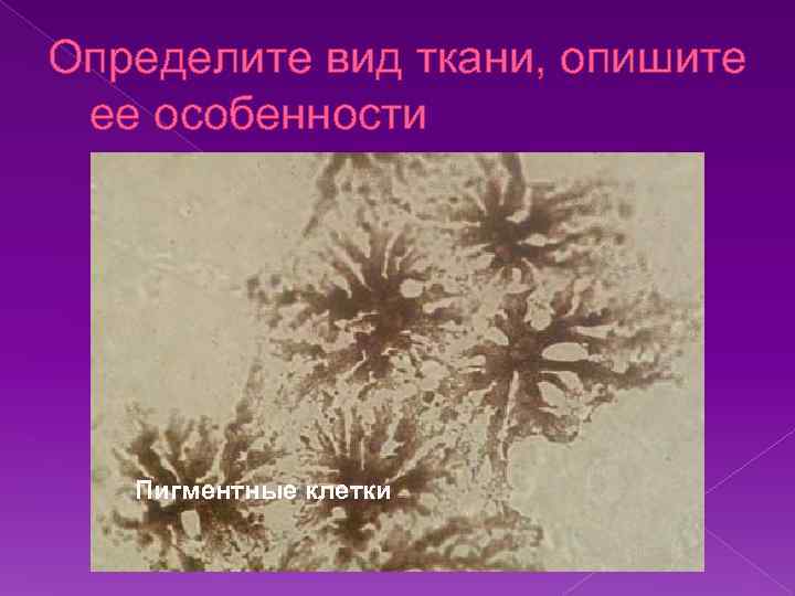 Определите вид ткани, опишите ее особенности Пигментные клетки 