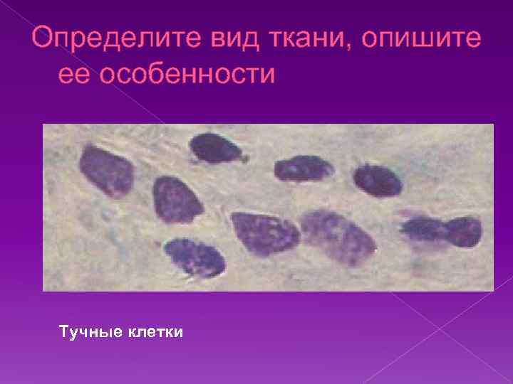 Определите вид ткани, опишите ее особенности Тучные клетки 