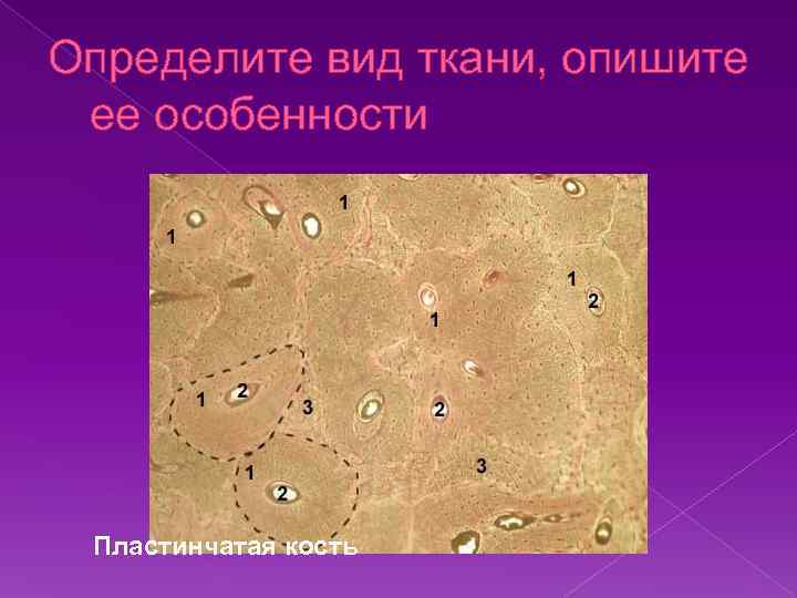 Определите вид ткани, опишите ее особенности Пластинчатая кость 