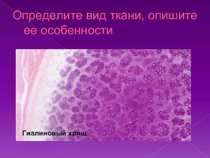 Определите вид ткани, опишите ее особенности Гиалиновый хрящ 