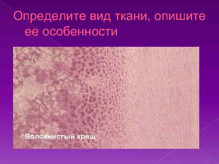 Определите вид ткани, опишите ее особенности Волокнистый хрящ 