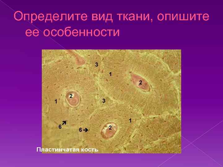 Определите вид ткани, опишите ее особенности Пластинчатая кость 