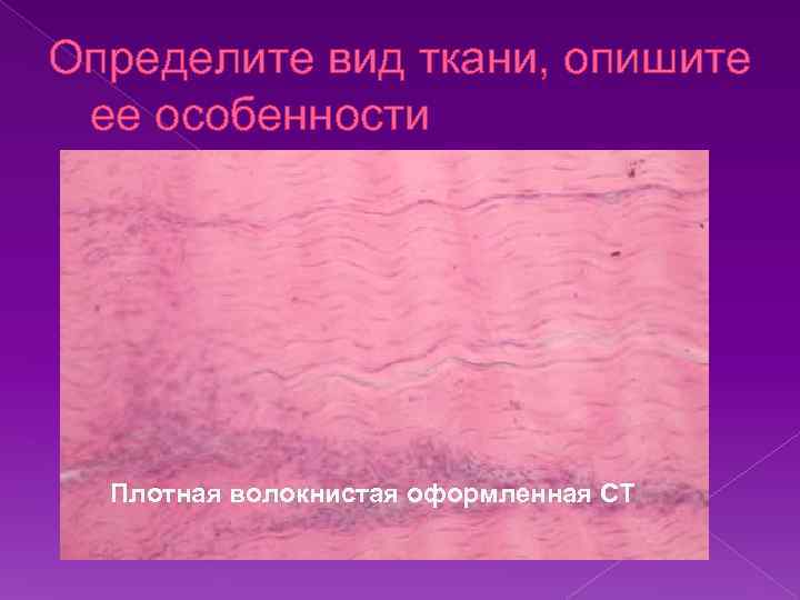 Определите вид ткани, опишите ее особенности Плотная волокнистая оформленная СТ 