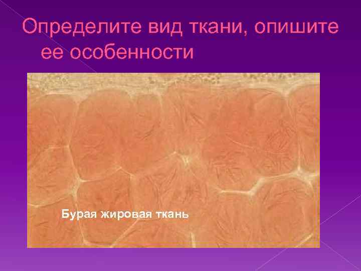 Определите вид ткани, опишите ее особенности Бурая жировая ткань 