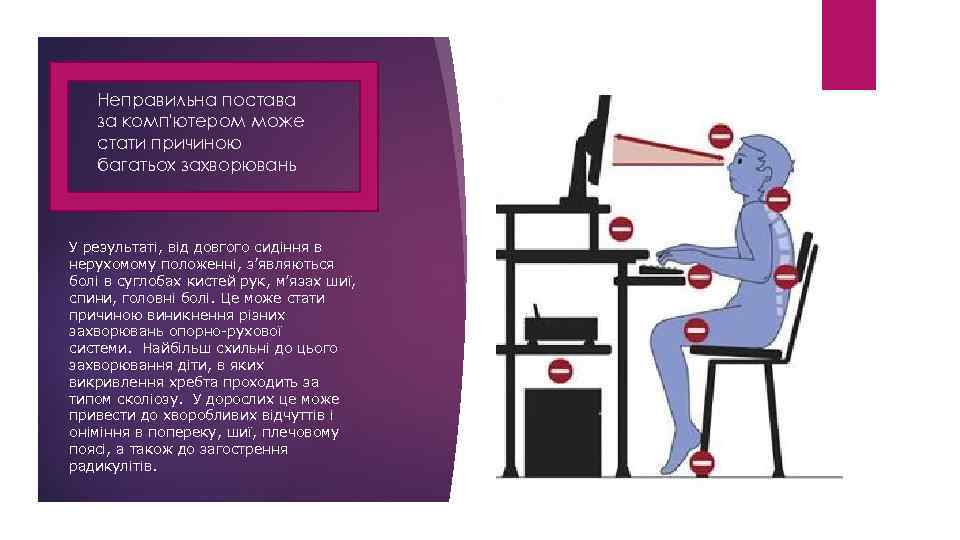 Неправильна постава за комп'ютером може стати причиною багатьох захворювань У результаті, від довгого сидіння