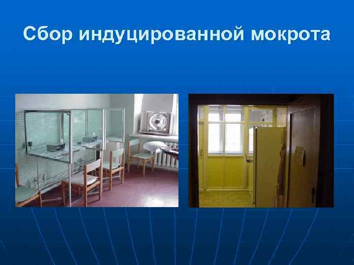 Сбор индуцированной мокрота 