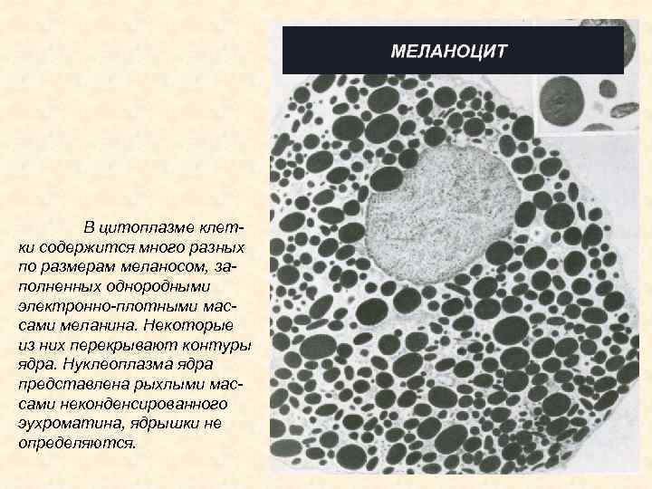 В цитоплазме клетки содержится много разных по размерам меланосом, заполненных однородными электронно-плотными массами меланина.