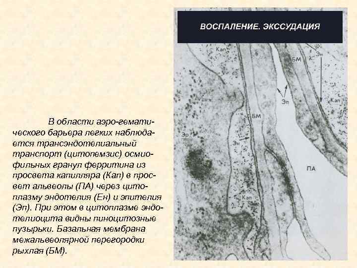 В области аэро-гематического барьера легких наблюдается трансэндотелиальный транспорт (цитопемзис) осмиофильных гранул ферритина из просвета