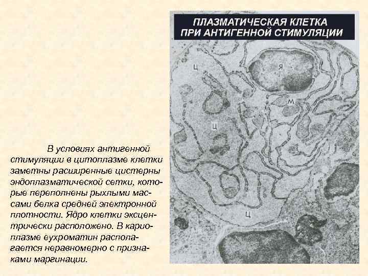 В условиях антигенной стимуляции в цитоплазме клетки заметны расширенные цистерны эндоплазматической сетки, которые переполнены