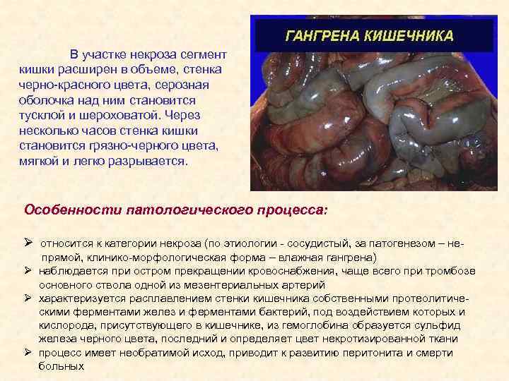 В участке некроза сегмент кишки расширен в объеме, стенка черно-красного цвета, серозная оболочка над