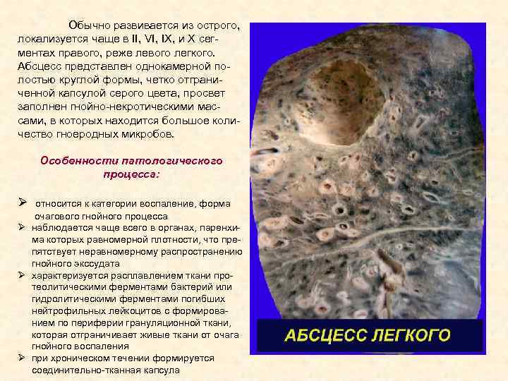 Обычно развивается из острого, локализуется чаще в ІІ, VI, IX, и X сегментах правого,